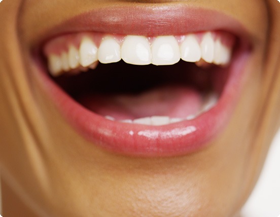 Gummy Smile | Alberta Academy of Periodontics | Periodontists | Alberta
