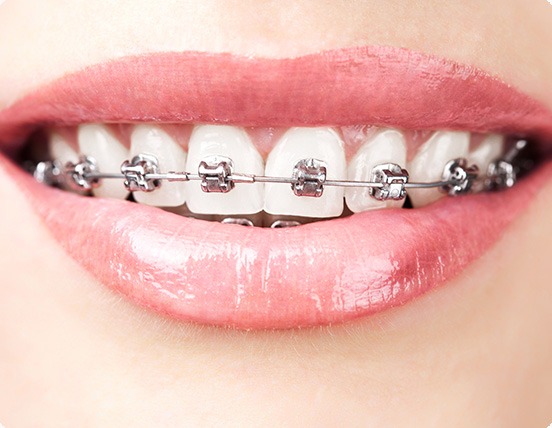 Tooth Exposure for Orthodontics | Alberta Academy of Periodontics | Periodontists | Alberta